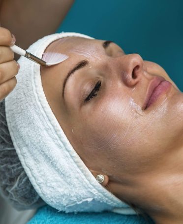 Chemical Peel-min