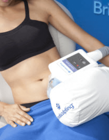 Coolsculpting Profile (1)